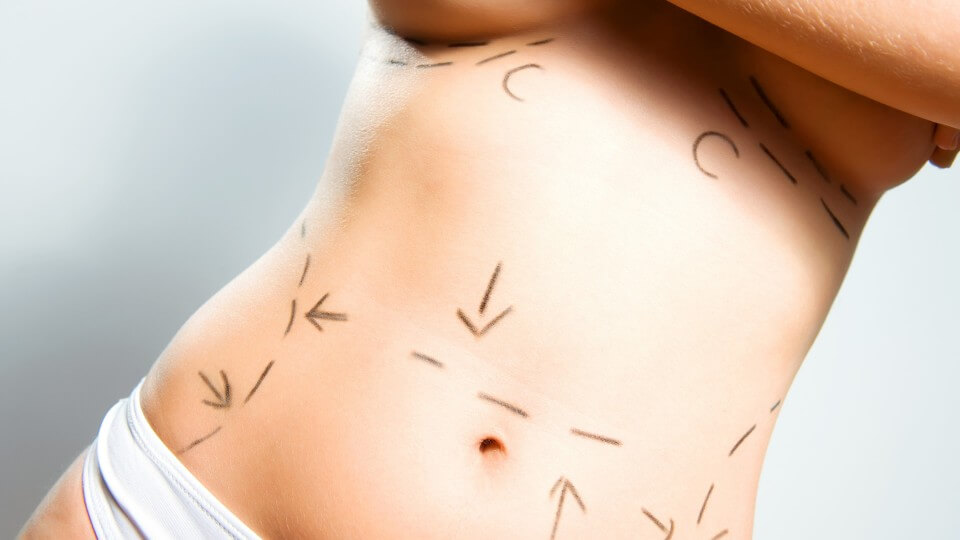 tendências para cirurgia plástica em 2018 diversos procedimentos
