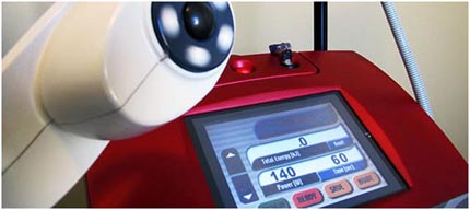 Equipamento de Ultra Accent tratamento para flacidez da pele