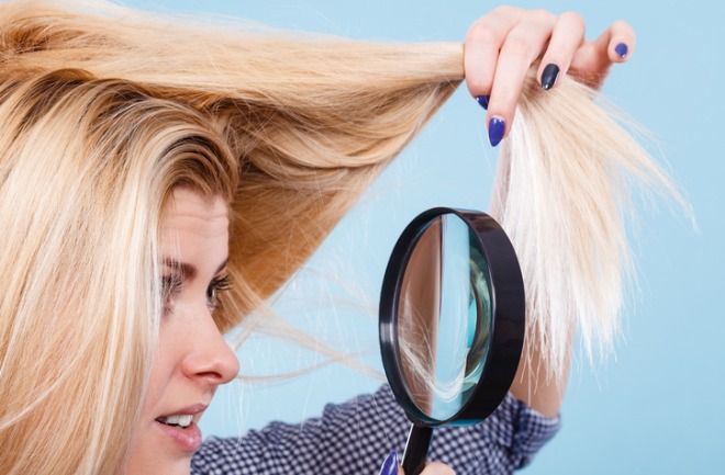 pacientes com alopecia androgenética podem descolorir o cabelo? mulher com alopecia androgenética com cabelo descolorido
