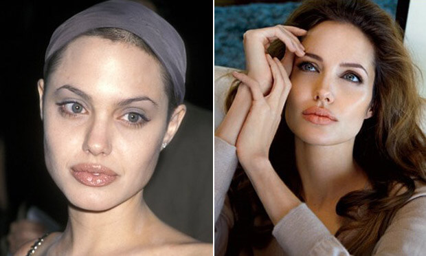 angelina jolie cirurgia plastica
