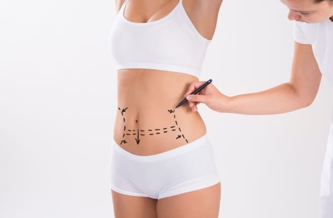 areas do corpo tratadas com lipoaspiração