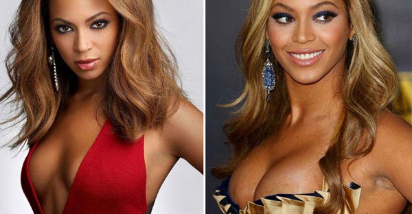 beyonce cirurgia plastica