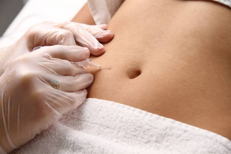 mulher fazendo carboxiterapia procedimento carboxiterapia