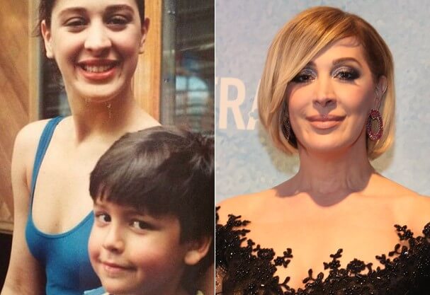 claudia raia cirurgia plastica