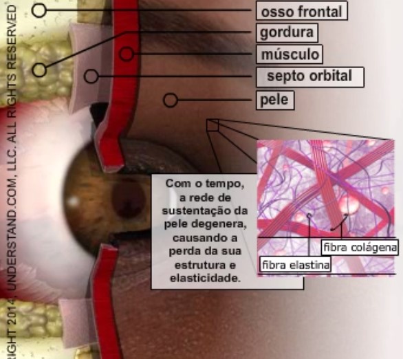 Como funciona a cirurugia de pálpebras Como funciona a cirurugia de pálpebras