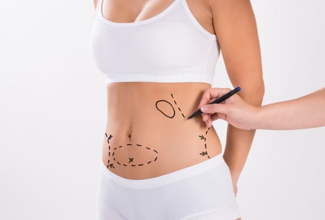 entenda como é o pós-operatório da hidrolipo
