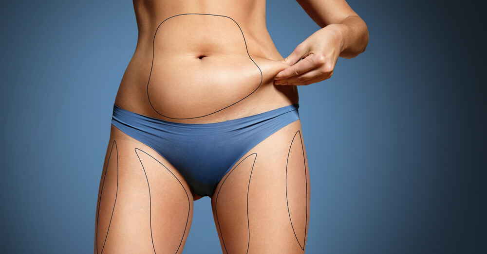 Veja as melhores plástica após a gestação, a lipoaspiração está entre as melhores Veja as melhores plástica após a gestação, a lipoaspiração está entre as melhores
