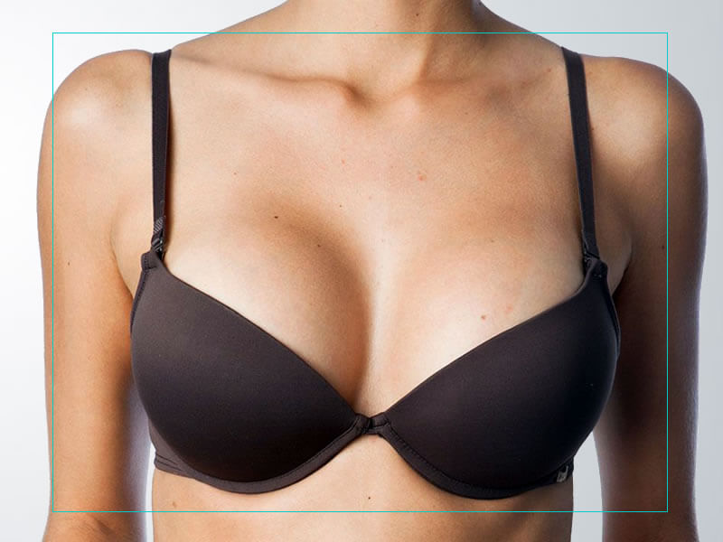Silicone nos seios com momento específico para renovar Silicone nos seios com momento específio