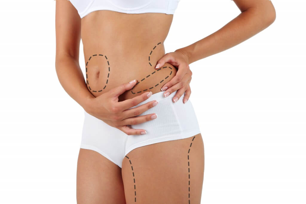 Saiba como funciona no restante do corpo com o enxerto de gordura Como funciona no restante do corpo com o enxerto de gordura
