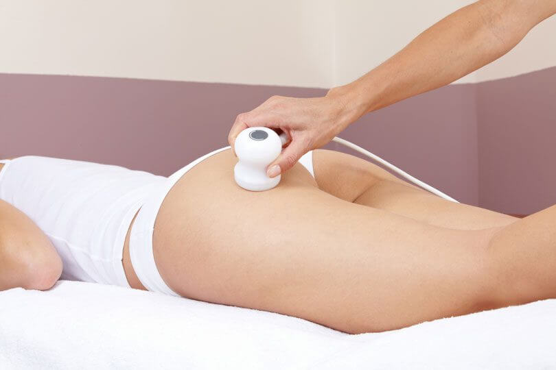Mulher Fazendo Procedimento A Laser Procedimento A Laser Para Estrias