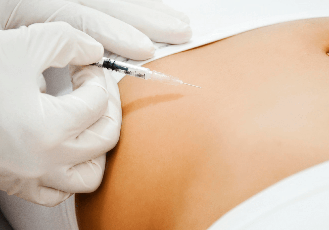 Carboxiterapia entre os melhores procedimentos quando pensamos em tratamento para estrias Tratamento Para Estrias com a Carboxiterapia
