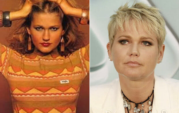 xuxa meneguel cirurgia plastica